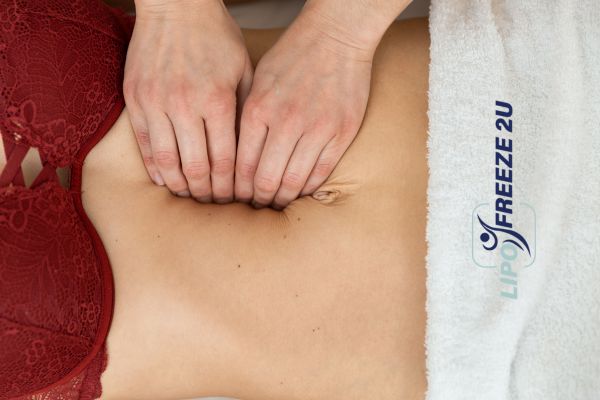 diastasis recti treatment Cardiff