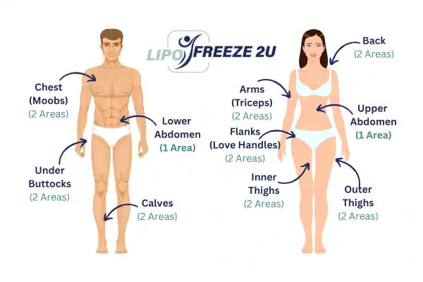 Areas you can have fat freezing treatment Cardiff