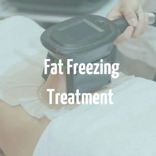fat freezing treatment Cardiff