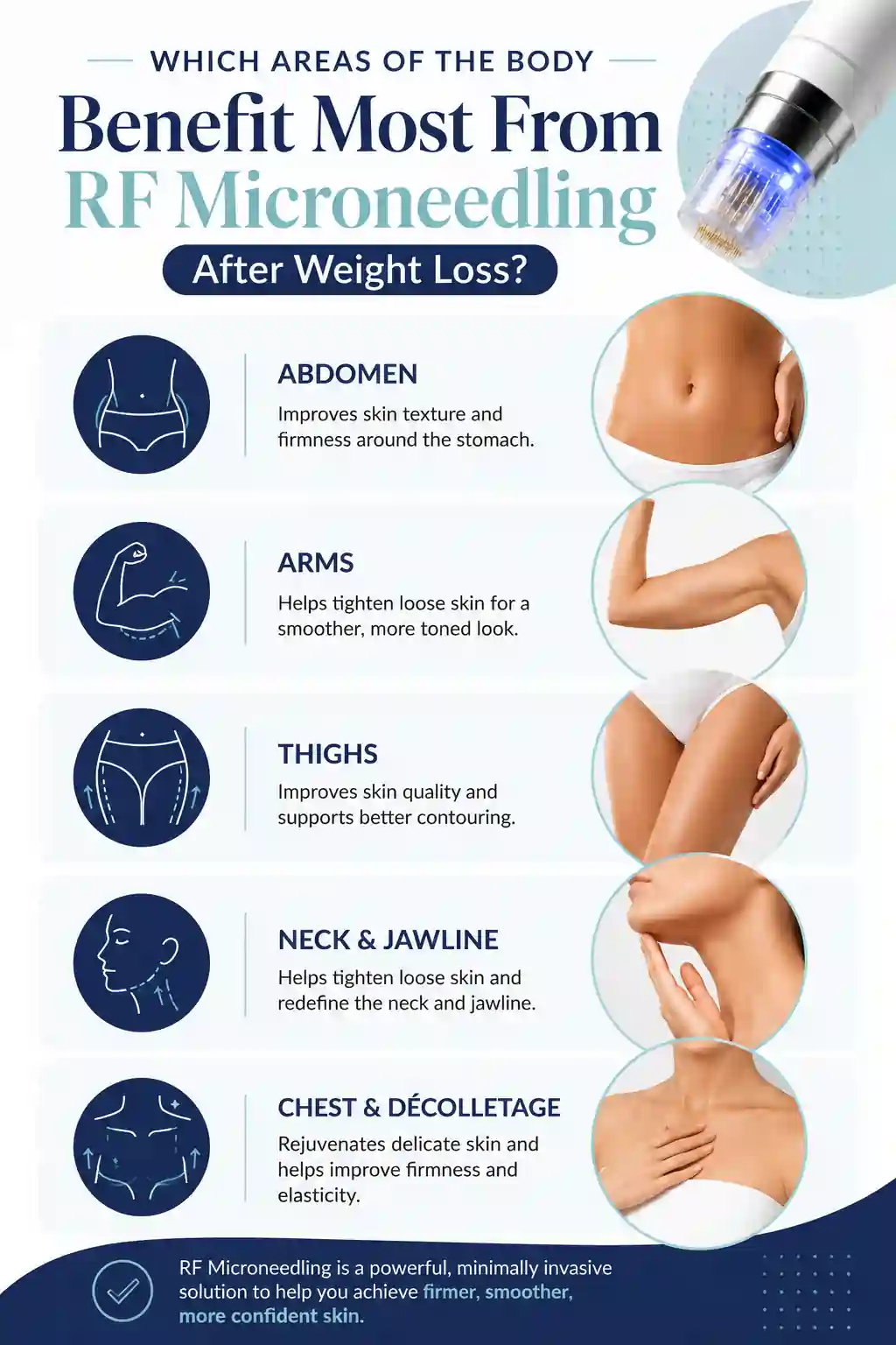 Which Areas of the Body Benefit Most From RF Microneedling After Weight Loss Cardiff